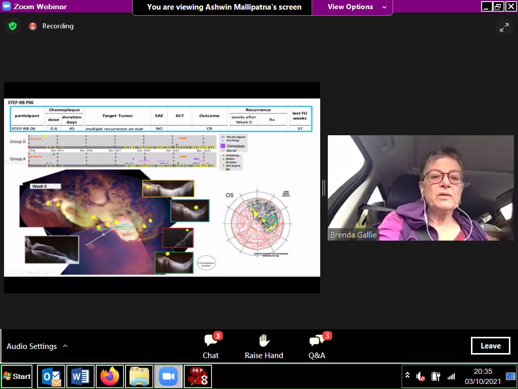 wechope's tweet photo. #OneRbWorld2021 Day3: from the road, Prof Brenda Gallie presented #chemoplaque #ClinicalTrial results. Positive outcomes for kids who faced #enucleation after therapy failure. Consideration of #extraocular risk is vital. #Vitritis the only #toxicity so far; monitoring continues. https://t.co/k2kXH00BrE