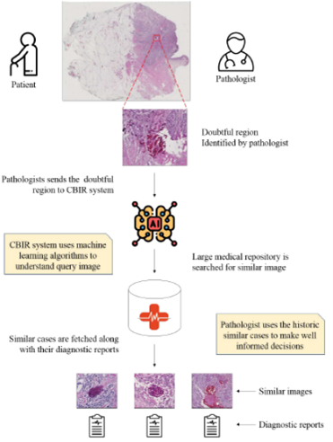 clarify_project's tweet photo. New post in our #blog!
In CLARIFY we are going to prepare a consulting network for #pathologists by #MachineLearning. See this new post to know what #ContentBasedImageRetrieval (#CBIR) is and the challenges behind it.
๐ https://t.co/xD69ovD3f8 https://t.co/ehZxjxu3r6