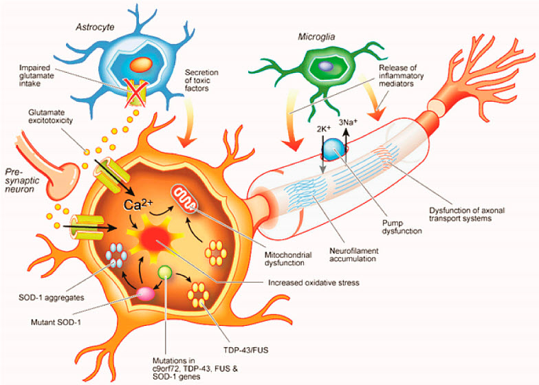 MolecularCloud Article - CRISPR/Cas9 Based Preclinical Advances for Amyotrophic Lateral Sclerosis molecularcloud.org/p/crispr-cas9-…