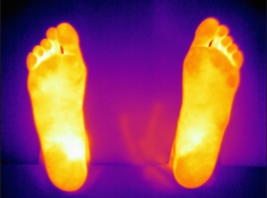 Consulta los artículos en pre-publicación de la Revista Española de Podología. Simetría en la temperatura podal en pacientes diabéticos y su relación con el índice postural del pie. ow.ly/yIjn50GsYSj <a href="/CGPodologos/">Consejo General de Colegios Oficiales de Podólogos</a> Consejo General de Colegios Oficiales de Podólogos