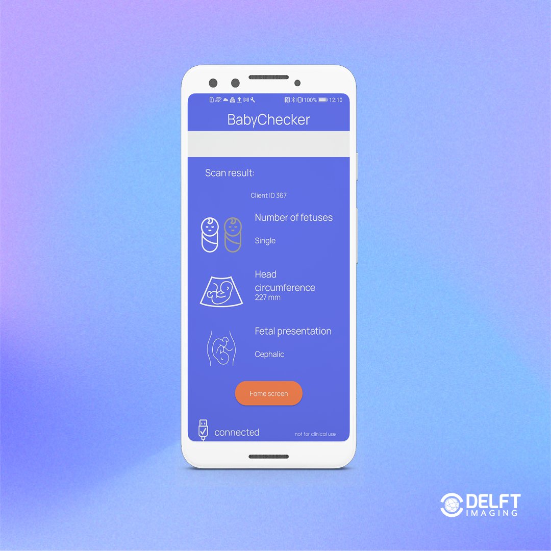 DelftImaging's tweet photo. BabyChecker uses #AI to detect important factors such as the gestational age, number & position of foetuses and the location of the placenta.
#BabyChecker is under research. Follow our page for more.
https://t.co/Ky820Jx7hQ
#digitalhealth #POCUS #delftimaging #imageanalysis https://t.co/72VevranzR