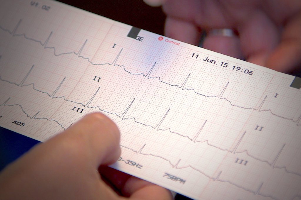 #ثريد 
راح نتكلم اليوم عن
ECG basics part 1
للمختصين في المجال الصحي
❤️