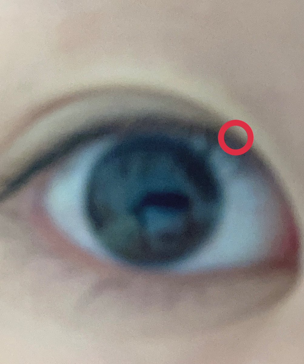 un_skp18's tweet image. 〈3日目〉
なんと二重線が二つあることが今日発覚した笑
2枚目が私がなりたい二重です笑
若干二重が始まってるところが違うのわかるかな〜(共感求む)

アイプチをする時には気をつけましょう。

＃100日後に二重になるJK 
＃3日目
#一緒に頑張ってくれる人募集中