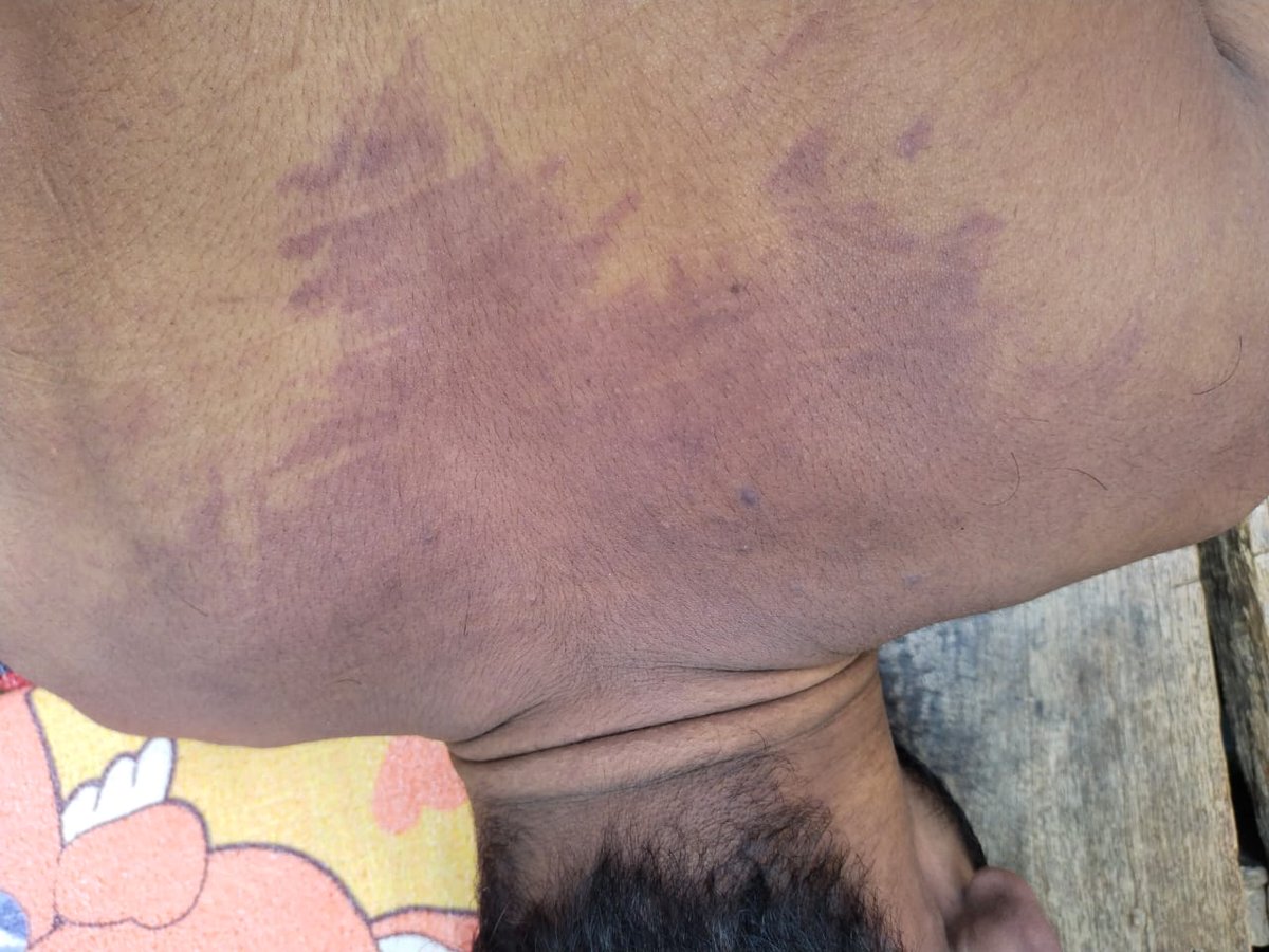 iamharsh0's tweet photo. I request all of you with folded hands, please give justice to our brother Pripesh Shukla, where it is clearly visible that he has been killed by poisoning, there our news channels and newspapers are showing that his death Has happened due to current, bring him justice 🙌🏻💔😔 https://t.co/sgsZZAdzsB