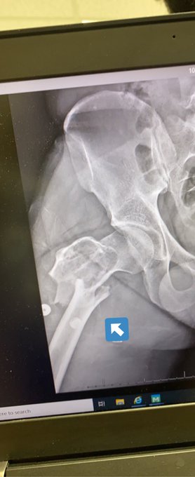 Gonna be spending the next few days visiting Logan in the hospital. Broke his femur, will be live when