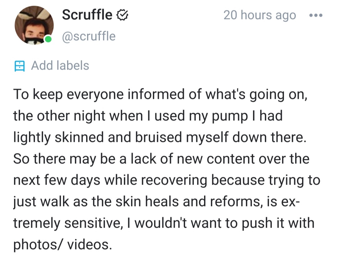 Posted this last night on my @OnlyFans page. Slowly recovering but dont expect anything new for a few
