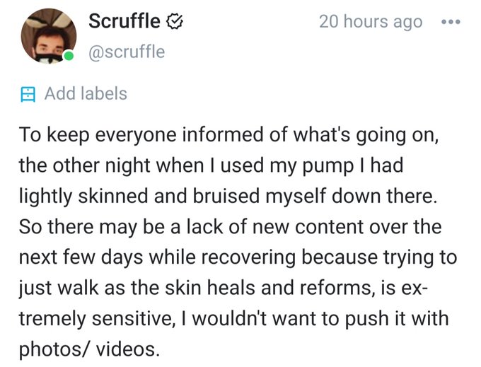 Posted this last night on my @OnlyFans page. Slowly recovering but dont expect anything new for a few