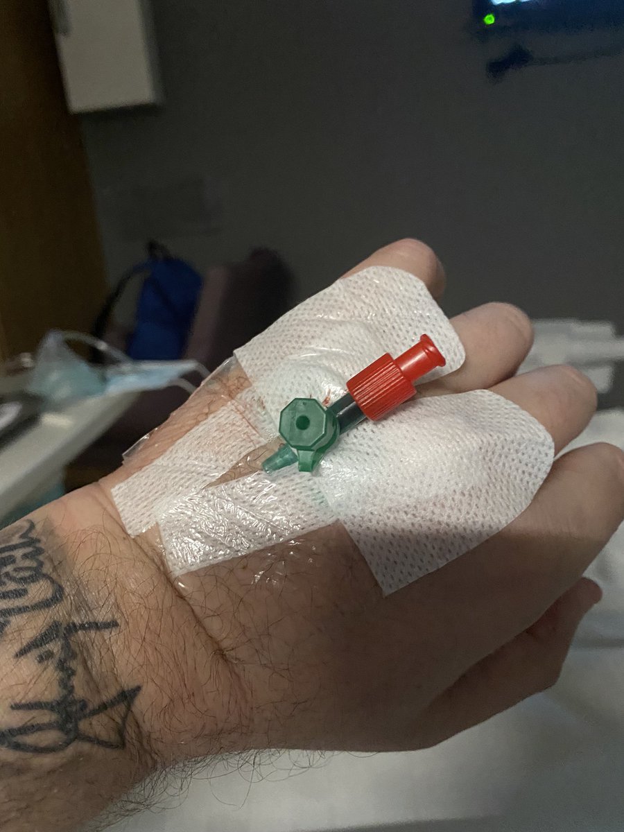 RockCowboyPhil's tweet photo. Bruises on bruises,feeling like a pin cushion,tubes removed,shaved belly & a mother of a headache,but up & out of bed,hopefully heading outside soon๐ท๐๐ป๐ท#FreshAirNeeded https://t.co/caKVS7xGz5