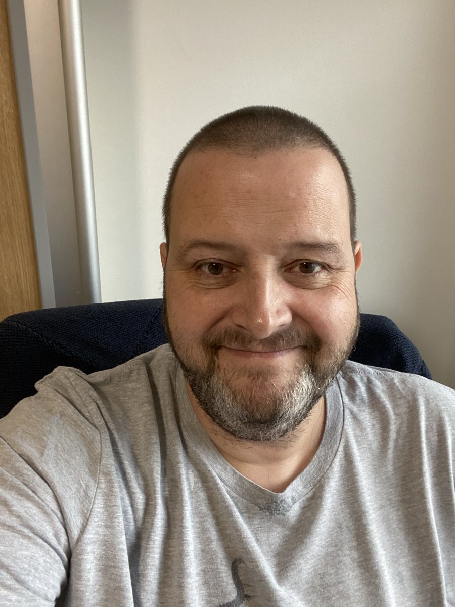 RockCowboyPhil's tweet photo. Bruises on bruises,feeling like a pin cushion,tubes removed,shaved belly & a mother of a headache,but up & out of bed,hopefully heading outside soon๐ท๐๐ป๐ท#FreshAirNeeded https://t.co/caKVS7xGz5