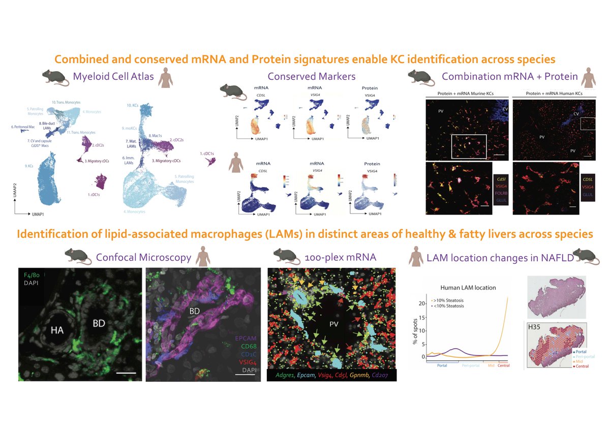Charlotte Scott (@kc_dc_01) on Twitter photo Our 1st pre-print! A spatial proteogenomic atlas of the healthy mouse & human liver generated with <a href="/MartinGuilliams/">Martin Guilliams</a> lab. We identified genuine human KCs & conserved KC markers! Also we found steady state LAMs at the bile duct in both species! Check it out: doi.org/10.1101/2021.1… Our 1st pre-print! A spatial proteogenomic atlas of the healthy mouse & human liver generated with <a href="/MartinGuilliams/">Martin Guilliams</a> lab. We identified genuine human KCs & conserved KC markers! Also we found steady state LAMs at the bile duct in both species! Check it out: doi.org/10.1101/2021.1…