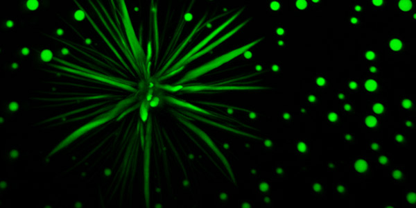Cell Press (@cellpressnews) on Twitter photo Xavier Darzacq on Live #cell #dynamics of Hypoxia Inducible Factors reveals a function of their IDR in target search and chromatin engagement #CSBioAssemblies, Nov 1-3. Register by Oct 29 to join live <a href="/TjianDarzacq/">Tjian + Darzacq Group</a> <a href="/XDarzacq/">Xavier Darzacq</a> <a href="/UCBerkeley/">UC Berkeley</a> hubs.li/H0ZdPsZ0 Xavier Darzacq on Live #cell #dynamics of Hypoxia Inducible Factors reveals a function of their IDR in target search and chromatin engagement #CSBioAssemblies, Nov 1-3. Register by Oct 29 to join live <a href="/TjianDarzacq/">Tjian + Darzacq Group</a> <a href="/XDarzacq/">Xavier Darzacq</a> <a href="/UCBerkeley/">UC Berkeley</a> hubs.li/H0ZdPsZ0