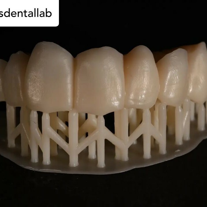 3dheals's tweet photo. #repost @vellisdentallab #vellisdentallab #provisionalbridge #dental3dprinting #3dprinted #3dprinting #3dprinter #flashforgehunter #dentallaboratory  #dentallab #dentalservices #dentaltechnician #dentaltechnology #digitaldentaltechnology #dentistrylife #dentista #dentist #de… https://t.co/HvnmkgEOmF
