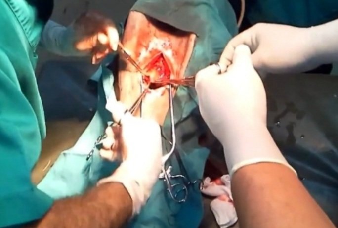#Hipismo CIRUGIA EQUINA 
(30) CONOCIMIENTO ANATOMICO: Es indispensable para garantizar el éxito en la cirugia equina, tener antes de la intervención pleno conocimiento de la anatomía de la región, de la patología y de la técnica operatoria.