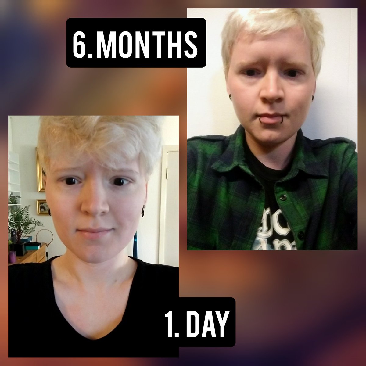 SoelveDeer's tweet photo. Today is my 6 months on testosterone ! A lot has happened, but I'm still looking forward to more changes 🏳️‍⚧️ https://t.co/q8n6xuFAdD