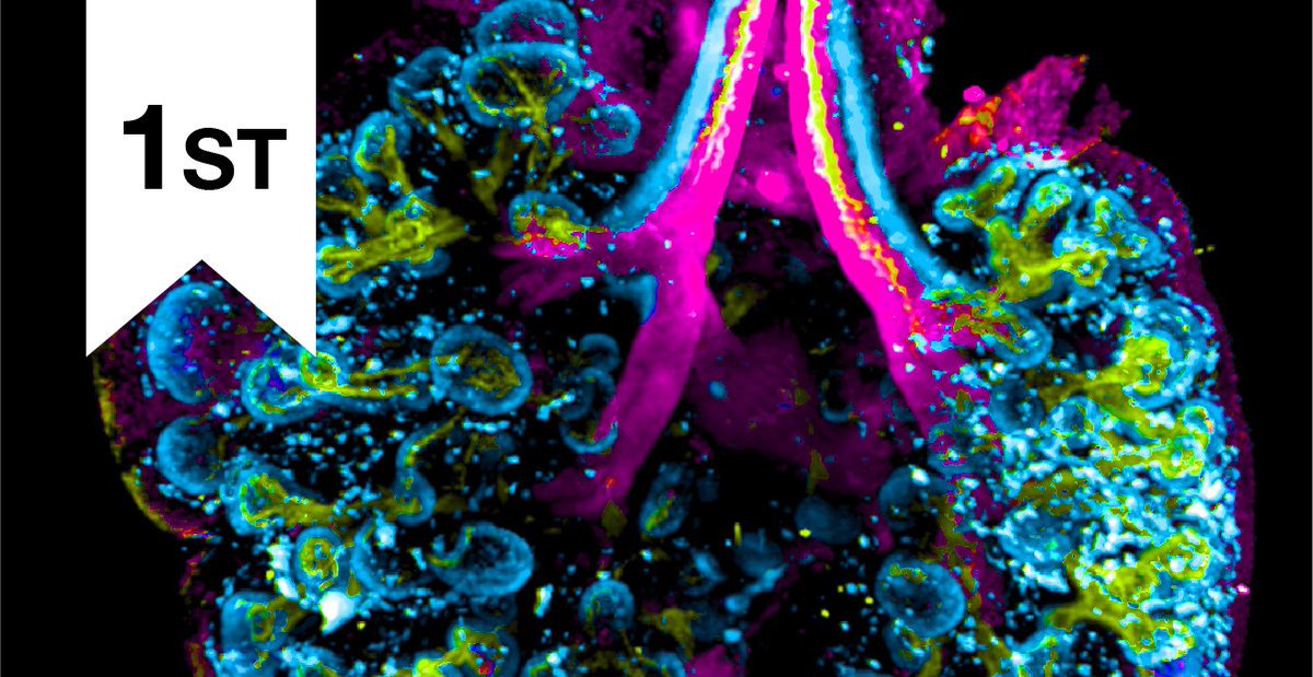 WEHI_research's tweet photo. Congratulations to Dr Casey Ah-Cann for achieving 1st place in the still image category for her image titled 'Air Force'

Discover more about Casey's research and the other incredible images at our interactive online exhibition https://t.co/IAR8fX3Dpr

#WEHIResearch https://t.co/P2TG614qlk