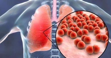 #الصحة_العالمية تحذر من إصابة هذه الفئة بـ #كورونا.. وتوجه هذه النصائح
akh24.me/eqZc50GsOqN