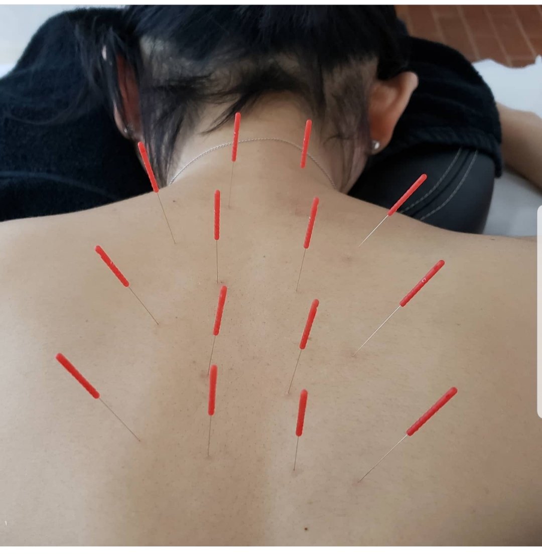 Cyclinglove Rt Masuimiho1006 Scapula Sucapularstability Scapularmobility Scapular Scapularstrength 肩甲骨はがし 肩甲骨 肩甲骨が凝る 肩甲骨の凝り 肩甲骨の凝り改善 Ro Twitter Cyclinglove Rt Masuimiho1006 Scapula Sucapularstability Scapularmobility Scapular Scapularstrength 肩甲骨はがし 肩甲骨 肩甲骨が凝る 肩甲骨の凝り 肩甲骨の凝り改善 Ro Twitter