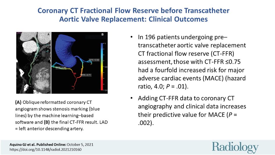 Gilberto Aquino (@aquinogilberto1) on Twitter photo First presented at <a href="/NASCISociety/">NASCI</a> 2021, now published in <a href="/radiology_rsna/">Radiology</a>! Coronary CT Fractional Flow Reserve in Pre-TAVR Assessment. Excellent effort by all co-authors! <a href="/TilmanEmrich/">Tilman Emrich</a> @basel_yacoub
pubs.rsna.org/doi/10.1148/ra…
<a href="/RSNA/">RSNA</a> <a href="/MUSCcvi/">MUSC Cardiovascular Imaging</a> #MedTwitter #futureradres #TAVR First presented at <a href="/NASCISociety/">NASCI</a> 2021, now published in <a href="/radiology_rsna/">Radiology</a>! Coronary CT Fractional Flow Reserve in Pre-TAVR Assessment. Excellent effort by all co-authors! <a href="/TilmanEmrich/">Tilman Emrich</a> @basel_yacoub
pubs.rsna.org/doi/10.1148/ra…
<a href="/RSNA/">RSNA</a> <a href="/MUSCcvi/">MUSC Cardiovascular Imaging</a> #MedTwitter #futureradres #TAVR