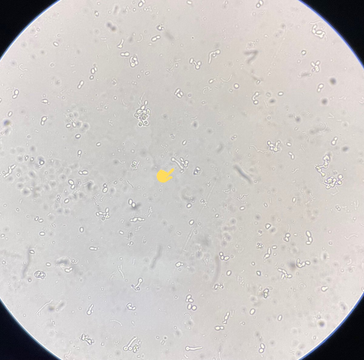 philipellorin_'s tweet photo. GERM TUBE TEST: screening test to differentiate Candida albicans from other yeast. 
(+) formation of short hyphal extension (without constriction) arising laterally from a yeast cell
@MedtechMustKnow 
@medtech_journal https://t.co/6oMgXNBhfx