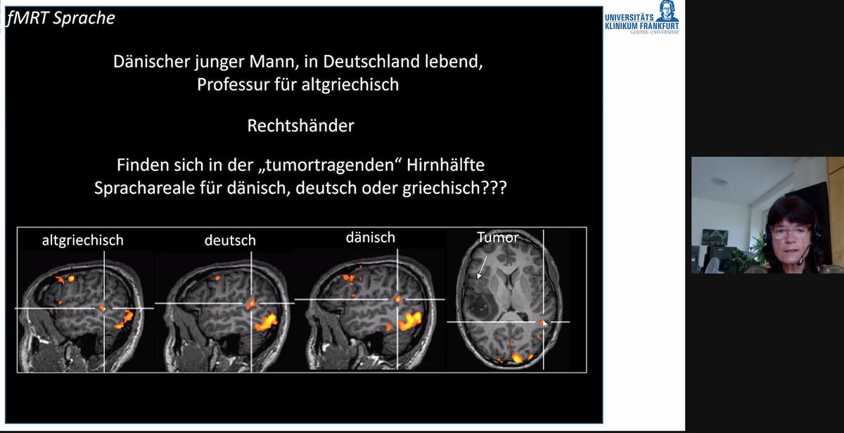 vivienrichtermd's tweet photo. Intersting fMRI study of a trilingual patient from Prof. Hattingen at the fMRI course #neurorad2021 @DGNR_org off to a great start https://t.co/CMJq7J7NMw