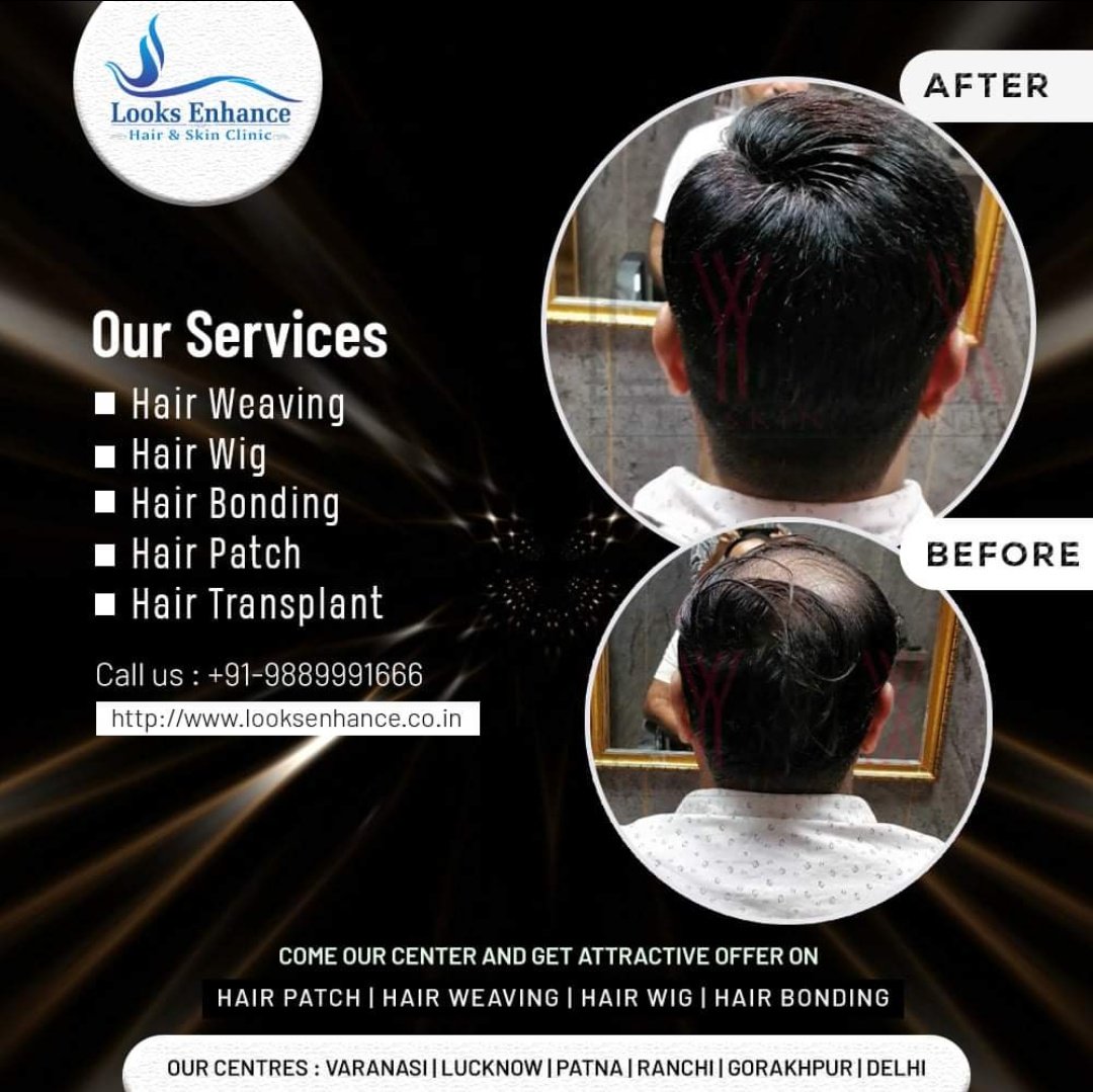 Arvind Gupta- Looks Enhance- Hair & Skin Clinic (@LooksEnhance) / Twitter Arvind Gupta- Looks Enhance- Hair & Skin Clinic (@LooksEnhance) / Twitter