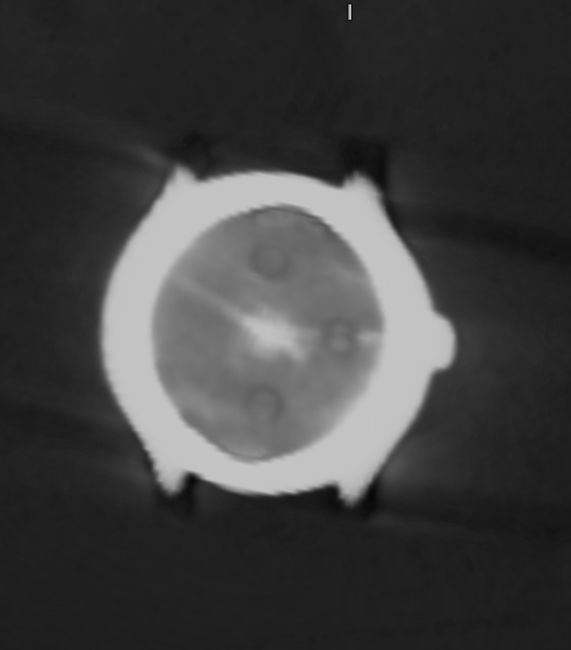 CtSpectral's tweet photo. When CT scanners get so good that you can tell the time  by looking at the patients watch...
#Radiology https://t.co/DO4FDU47sf