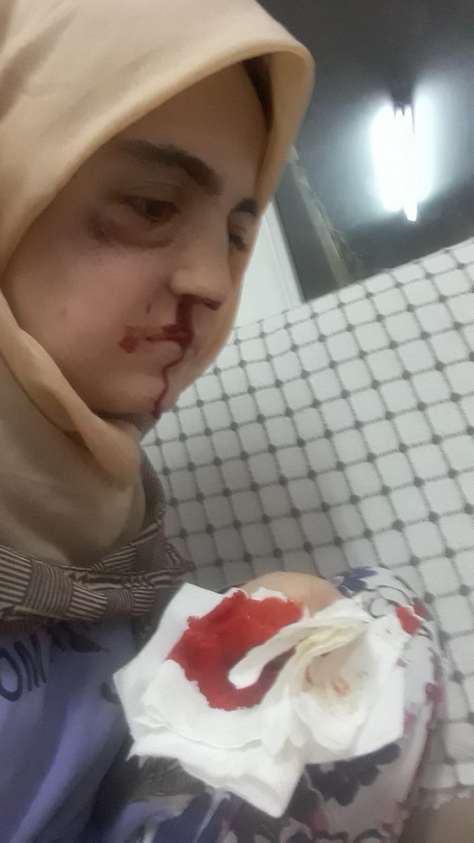 Biraz önce Ayşe Özdoğan'ın avukatıyla görüştüm. Cezaevinden tekrar hastaneye kaldırılan Özdoğan'ın durumunun kötü olduğunu, banyo vb. en temel ihtiyaçlarını karşılayamadığını söyledi. Ayşe Özdoğan bu haliyle tekrar cezaevine dönmemeli.