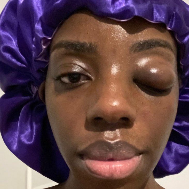 nationscoops's tweet photo. Belgian-Congolese dancer Jeny BSG who shot fame in viral video showcasing African dance moves with her Belgian student was victim of domestic violence by her ex-finance. 

We wishing you speedy recovery and thank God you are free 🙏🙏🙏 #domesticviolence #Dance https://t.co/rApY4QsSba