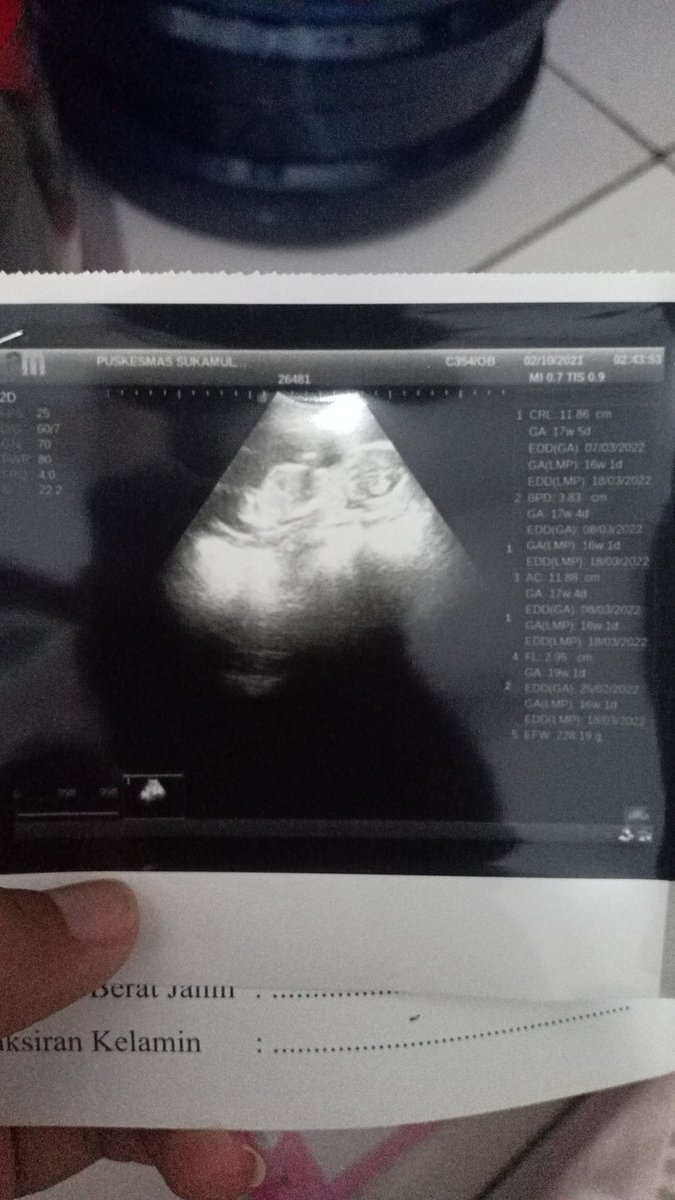 febbyrukmananda's tweet photo. 17w 3h ,🤰🥰✨ #TerpaksaMenikahiTuanMuda #Terpopuler #bumilmuda https://t.co/jSoUiOzVoj