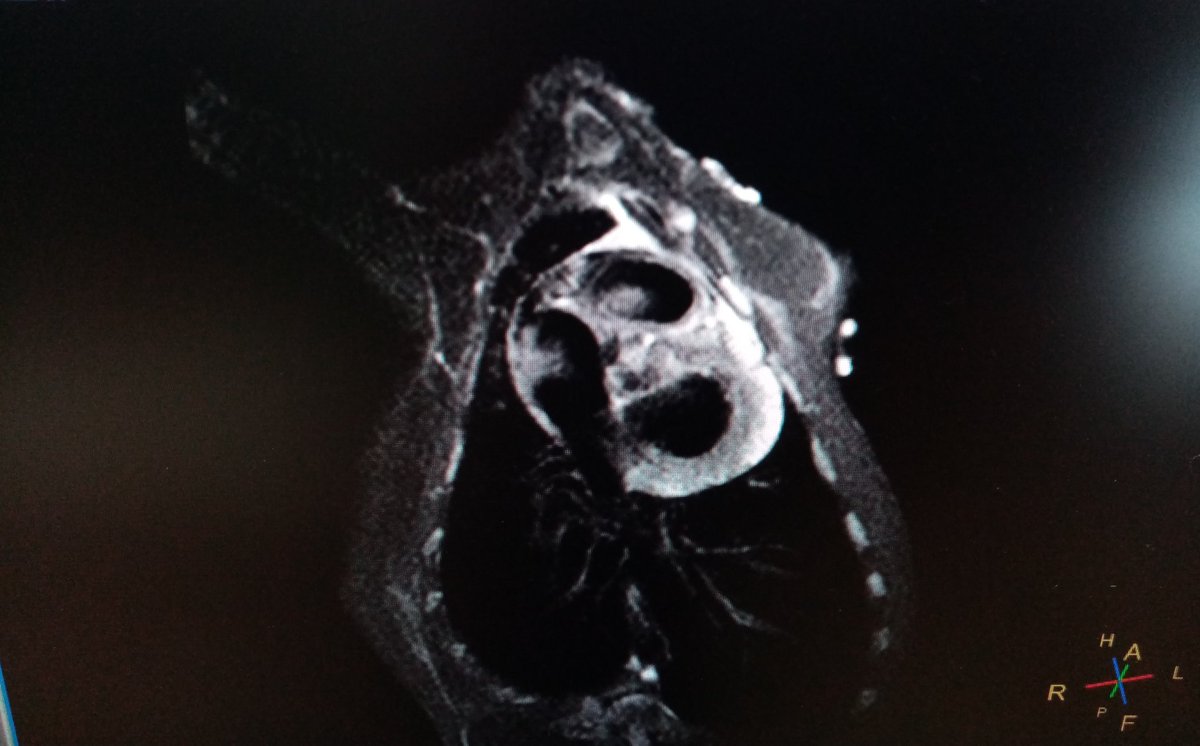 #scary_movie_cardio! Cardiac magnetic resonance imaging!