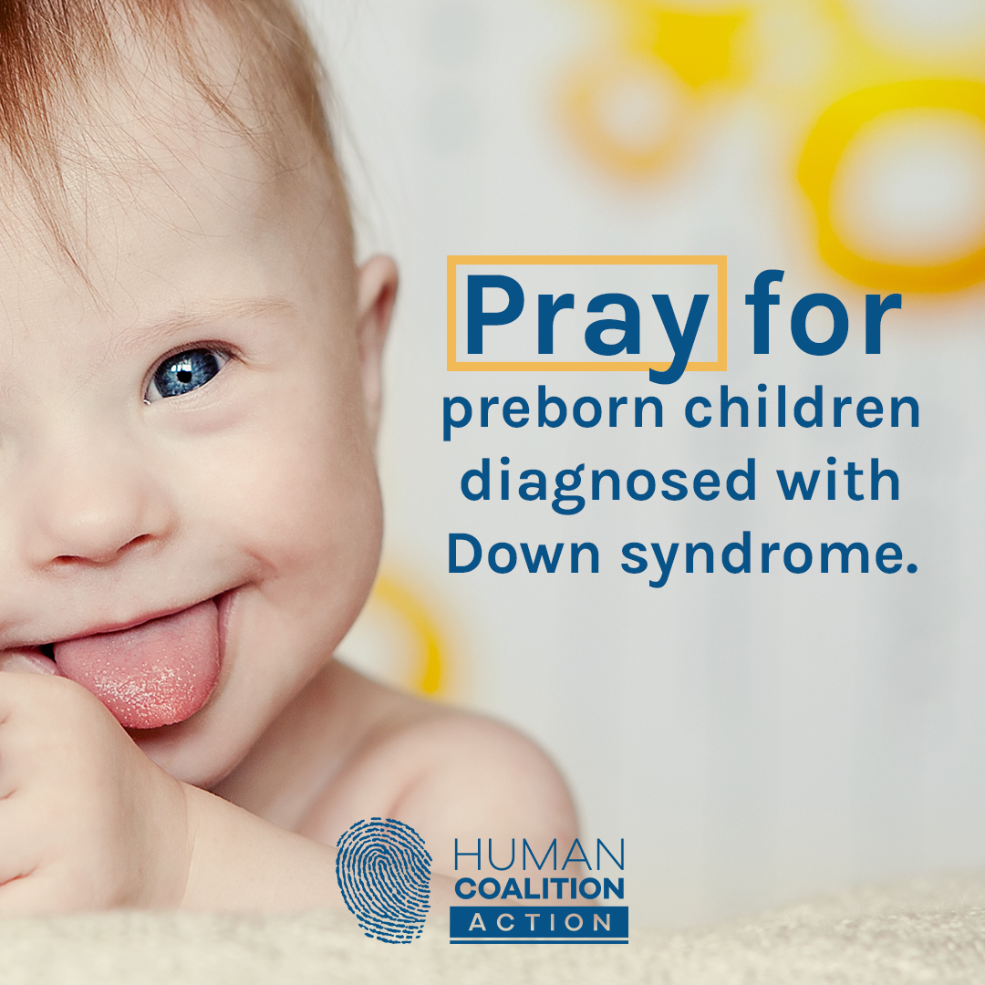 HuCoAction's tweet image. Preborn children with Down syndrome are among the most discriminated against population in the world. That’s why today, we ask you to join us in praying for the protection of all preborn children with Down syndrome. 

MORE: bit.ly/3EsPyts 

#DownSyndromeAwarenessMonth