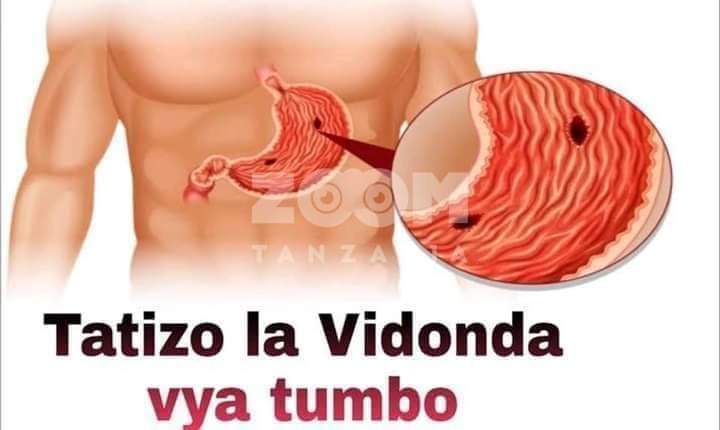 JE? UMESUMBULIWA NA VIDONDA VYA TUMBO BILA KUPONA KABISA KWA MUDA SASA?...NINA HABARI NJEMA #ThreadsOfLight Vidonda vya tumbo(Ulcers) ni ugonjwa unaowasumbua watu wengi kutokana na staili ya Maisha, Ulaji na Mazingira. Ugonjwa huu kitaalam unasababisha