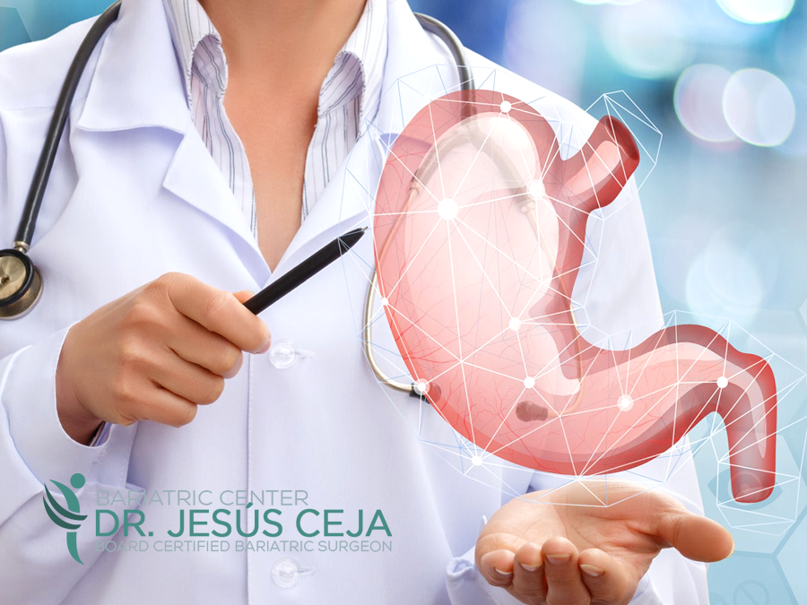 BariatrixTj's tweet photo. Experts in #bariatricsurgery in #Tijuana, #Mexico. Bariatric Surgery Tijuana offers gastric bypass, gastric sleeve and duodenal switch for weight loss.
https://t.co/YR0m8oQ4af https://t.co/l9sfMArpxO
