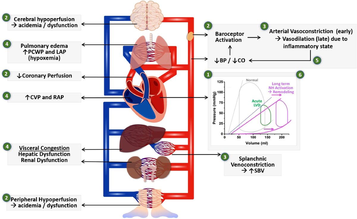 *MUST-READ* State-of-the-Art Review: 🌟HF-Related Cardiogenic Shock: Pathophysiology, Evaluation and Management Considerations🌟 @NavinKapur4 @BurkhoffMd @JHMontfort10 @vbluml @MohitpahujaMD @ShashankSinhaMD @cmrosner @VorovichHeartMD @AirInBags onlinejcf.com/article/S1071-…
