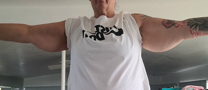 The downside of major weight loss. Soooooooo much skin. Can't wait for skin removal https://t.co/46q