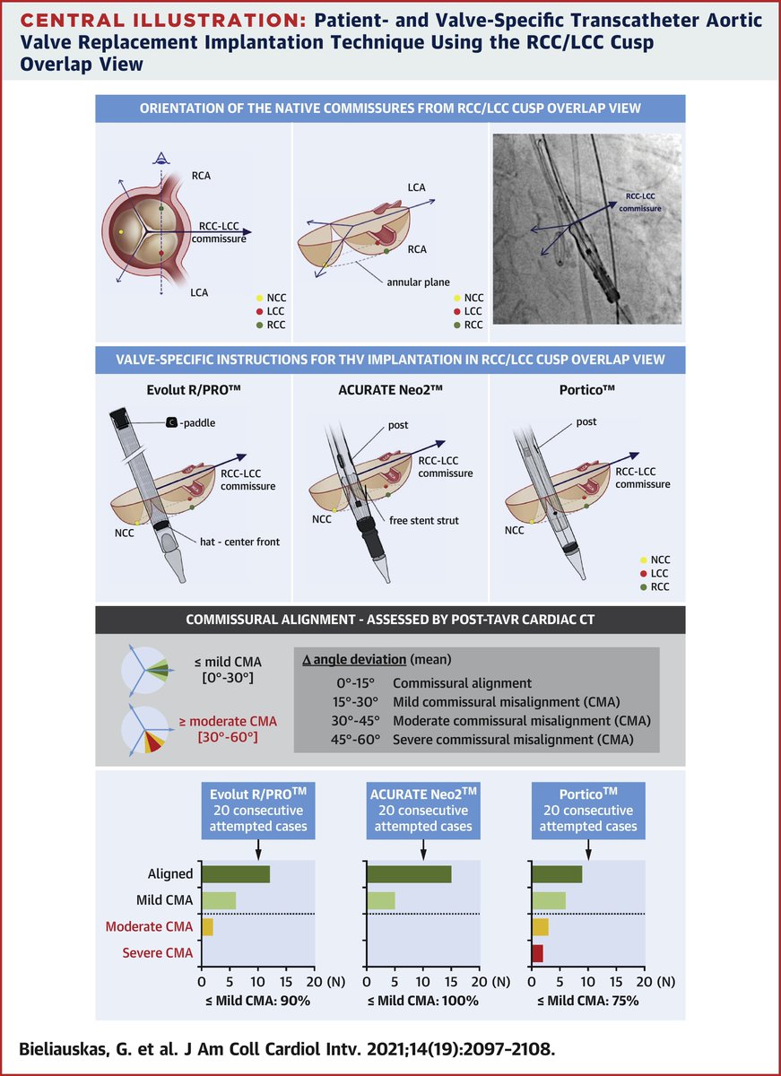 JACCJournals's tweet photo. Patient specific #TAVR technique to achieve #commissural alignment + low pacemaker rate: Pre-TAVR CT to obtain #cuspoverlap fluoroscopic angle to guide intraprocedural orientation of self-expanding #THV specific commissural markers. https://t.co/EhTm4FGDQM #JACCINT #CardioTwitter https://t.co/LSYwLaYRP3