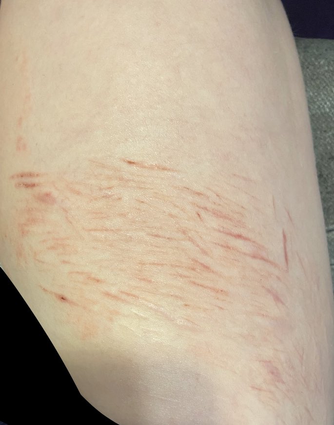 unworthyvoid's tweet photo. in 4 hours i’ll be a week clean
#shtwt #beanstwt #barcodetwt https://t.co/lhUNbvmaIZ
