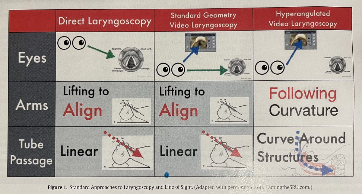 CBazzoliMD's tweet photo. Really like graphic (&amp; article) by LepaMD et al in this quarter’s Air Medical Journal.  VL increasing 1st pass success quite clear for some time, but still see practitioners and learners struggle to understand the when/why/how of SG vs HA which is so important. @AMPAdocs #MedEd https://t.co/9EeLh5MXre