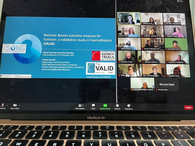 #VALID Great ideas discussed at the latest VALID GSC led by @a_viecelli International team dedicated to making a difference by validating a standardized core outcome measure for haemodialysis trials @song_initiative @tpinto_stats @charmaine_lok @allisontong1 @CarmelHawley