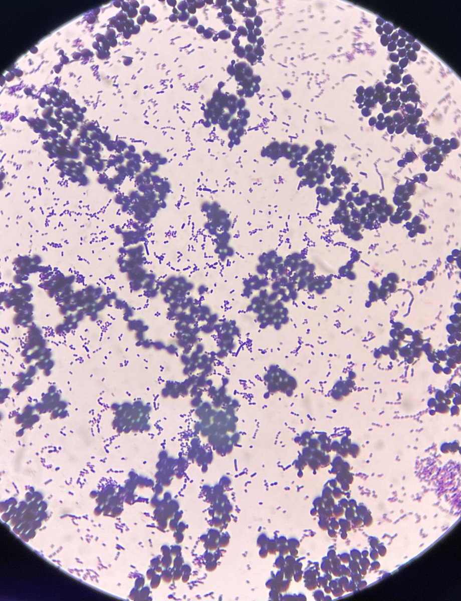 philipellorin_'s tweet photo. what we see under the microscope:
✅yeast cells
✅gram-positive bacilli
✅gram-positive cocci in chains
@MedtechMustKnow 
@medtech_journal https://t.co/sK4tJhZGLv