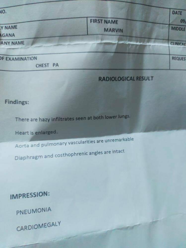 Hello po everyone, alam ko po medyo nakakahiya 'tong gagawin ko, but magiging patay hiya nlng po ako. Sana po matulungan niyo po ako about sa father ko po na sa 
ospital caused of mild pneumonia and heart enlargement. As of today po okay na po sya sa pneumonia but+++