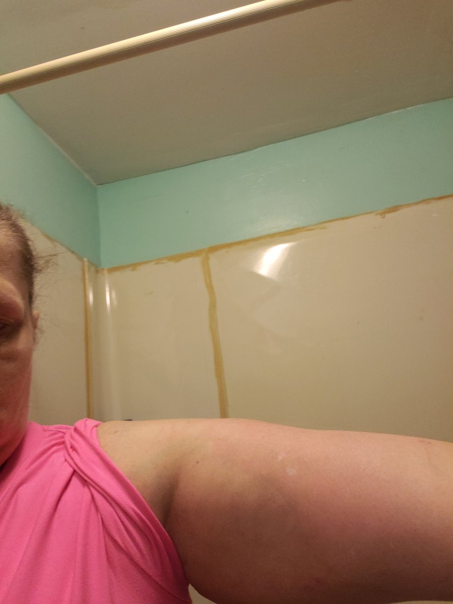 StephaneyRatli3's tweet photo. @Khing_Dav Look at my arm. I had flu and pneumonia shots yesterday in same arm. It hurts bad https://t.co/p5wdy4NtRp