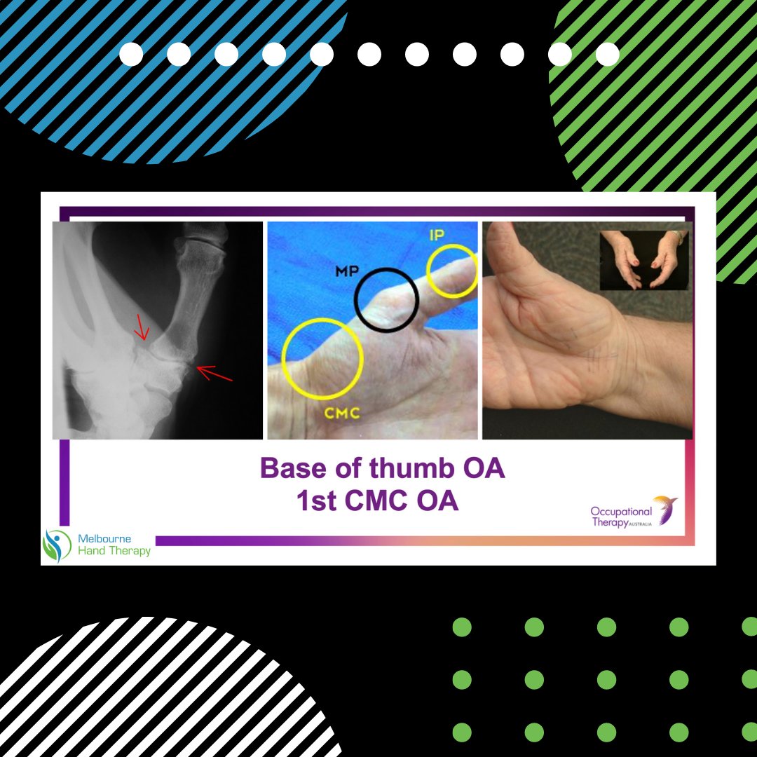 MelbourneHand's tweet photo. Today our wonderful therapists Jennifer Mathias and Kate Rayner presented to post graduate Occupational Therapists about “Assessing and Treating Arthritis in the Upper Limb”, for @otaust. https://t.co/qkKTQgd9MR