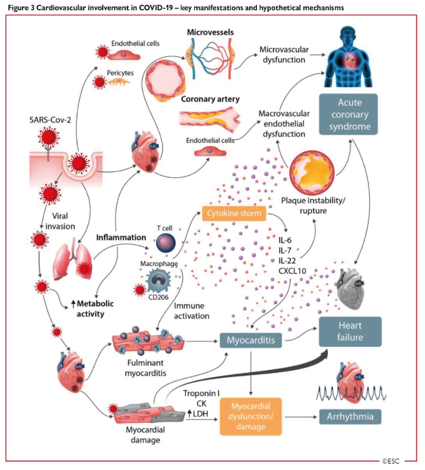 ESC_Journals's tweet photo. #AutonomicDysfunction in #COVID19 survivors is related to CV sequelae. #HRV bio feedback training modulates HRV enhancing #AutonomicFunction in CV pts. To include in Tx of #COVID_19 survivors? Answers in #CVPracticeJournal https://t.co/wKwNWMuaJT

@StefanoNistri #cardiotwitter https://t.co/lYLIHfdoPR