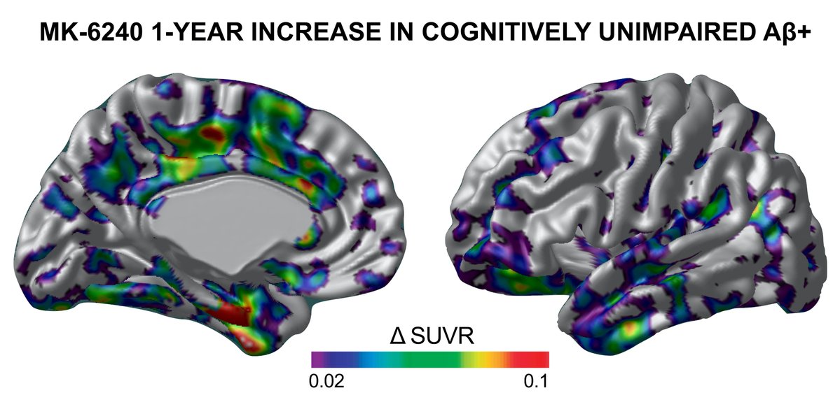 Brain tweet media
