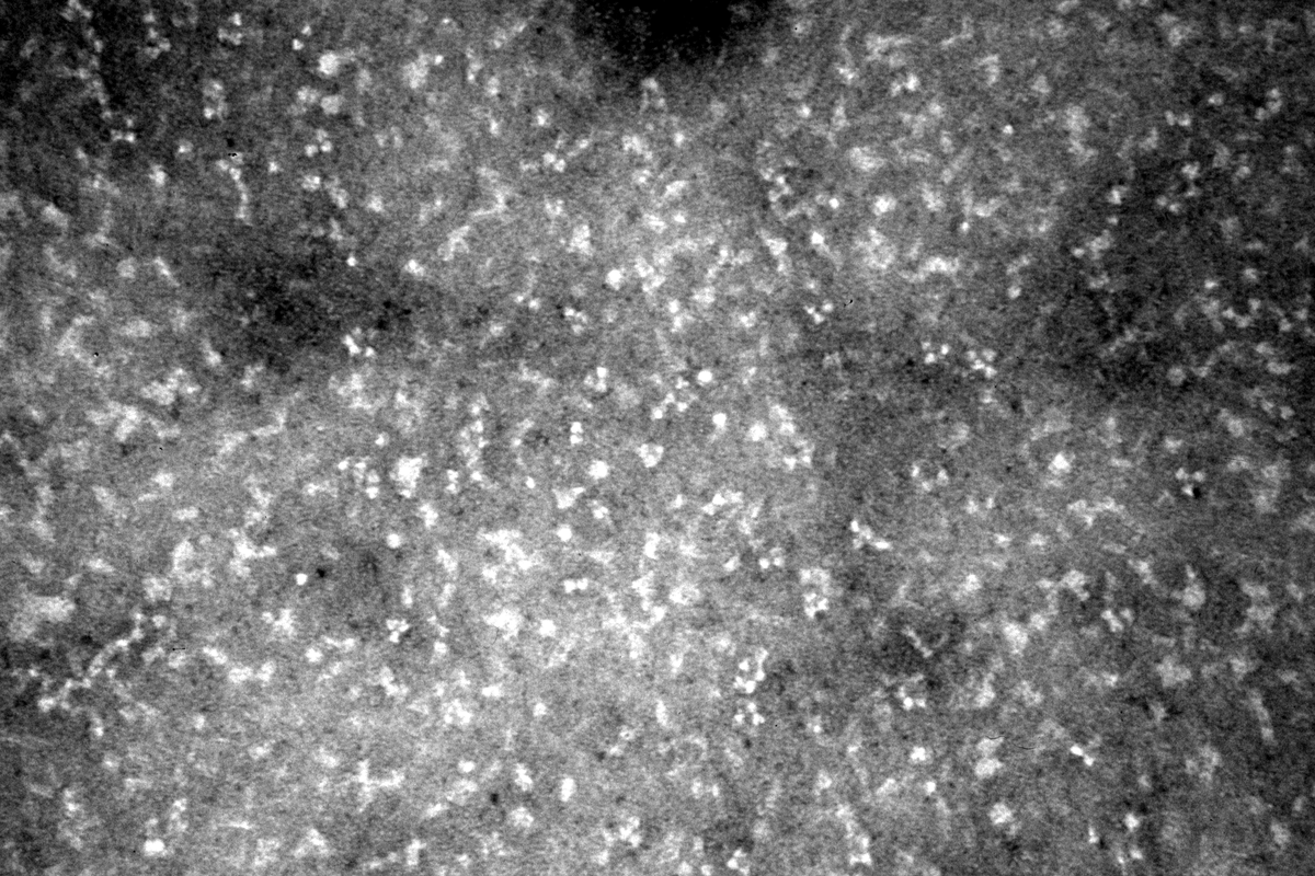 Matt_Arnold_Bio's tweet photo. Ah EM... such satisfying results.
@UofG_IIB : send us exciting images from your work!
Me: Ok!
Also me: What do you mean this micrograph of monochrome blobs isn't the visually stunning sci-art you were expecting?
@UofG_IIB: ...
#negativestain #negativeresponse https://t.co/2hBYNmGxLt