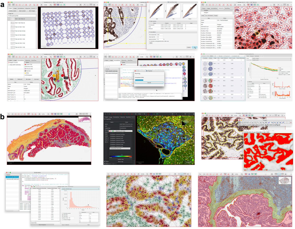 View analysis. Image analysis software. qupath. my sources.