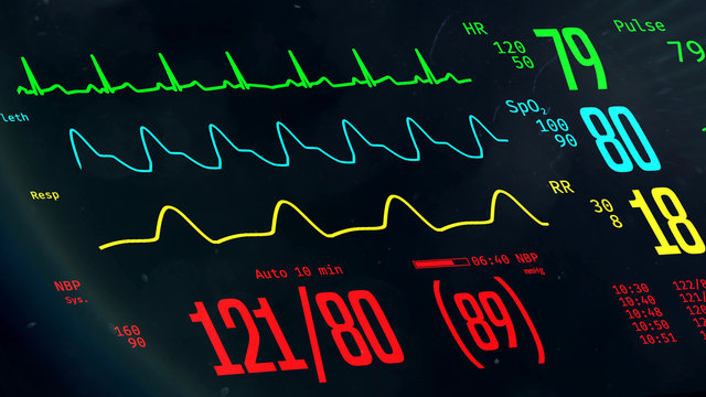 AllroundFact's tweet photo. #Vitalzeichen
sind von außen wahrnehmbare Lebensfunktionen
Atmung
Herztätigkeit
Körpertemperatur
Bewusstsein
Bei quantitativer Messung spricht man von #Vitalparameter
Atemfrequenz
arterieller Blutdruck - Pulsfrequenz
Körpertemperatur
Bewusstsein durch Scoresysteme https://t.co/1WKQbE6YGl