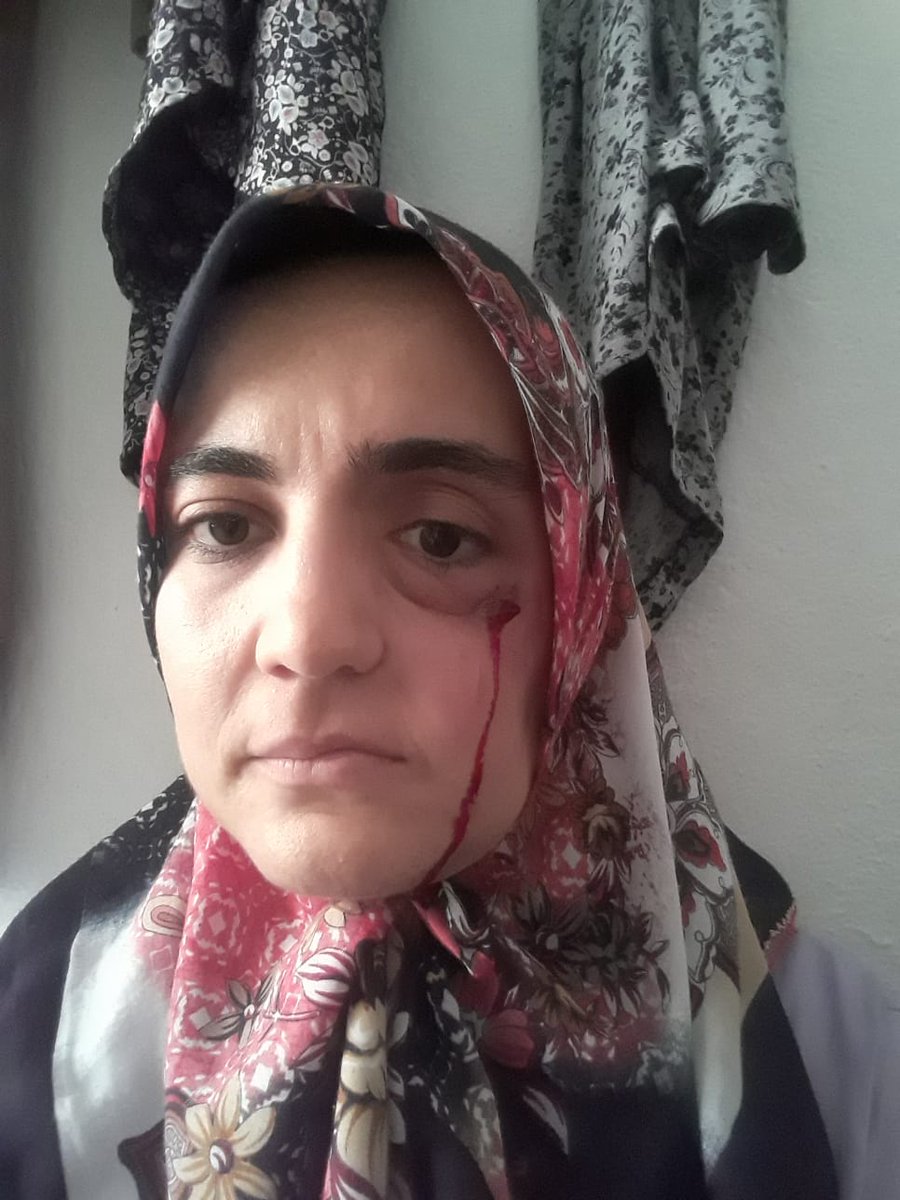 Soldaki, 20 suçtan,24 yıl ceza alan hükümlüydü; 2 yıl cezaevinde kaldı, korona tehlikesi gözetilerek tahliye edildi. Sağdaki <a href="/ayse_ozdogan1/">Ayşe Özdoğan</a> 4. evre kanser hastası ve yardıma muhtaç olmasına rağmen tutuklandı.

HastaMahpuslara AcilTahliye