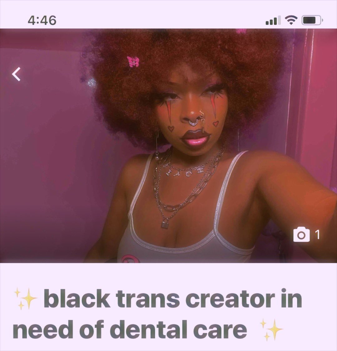 peachbyunniie's tweet photo. i’m a 23yr old black trans creative who needs help with dental care ! i’ve been struggling w/ mouth issues for the longest n i need RELIEF . links r n thread for the go fund me 💖 https://t.co/HSFNzzrQUU
